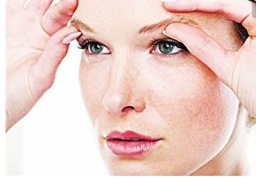 上海九院陳輝醫(yī)生_激光去斑案例分享：擁有細膩肌膚的秘訣曝光