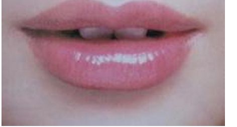 瑞美瑞亞整形醫(yī)院的吸脂案例及口碑盛傳!地址及其綜合評(píng)價(jià)揭秘!