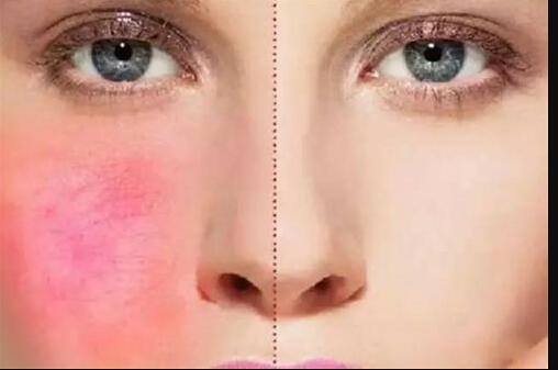 榆林雙眼皮修復(fù)誰的技術(shù)更值得信賴？