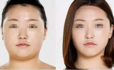 寧波2023年抽脂醫(yī)生排名揭曉！這幾位口碑爆棚的專家堪稱翹楚！