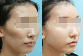 洛陽瘦腰整形醫(yī)院排名前五盛世推薦