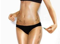 齊魯醫(yī)院大腿抽脂案例分享：專家解析、費用說明、效果好嗎