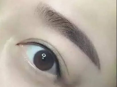 護眼實踐：林琦東如何改善視力？真實案例揭示眼部整形費用