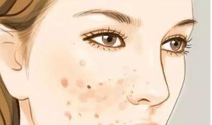 上海的醫(yī)院中，哪家醫(yī)院在祛痘方面比較有名？藝星和時光醫(yī)院的祛痘價格目錄和效果如何呢？