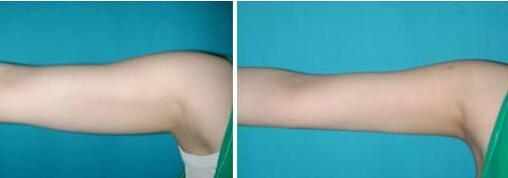 廈門(mén)美麗薇醫(yī)療美容診所值得信賴(lài)嗎？專(zhuān)業(yè)醫(yī)美整形機(jī)構(gòu)嗎？