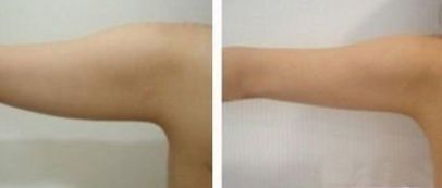 西部戰(zhàn)區(qū)一流眼科專家介紹，技術(shù)評估及收費參考