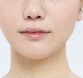 國(guó)內(nèi)哪些醫(yī)院在頜面整形方面做得更好？?jī)?yōu)質(zhì)正頜手術(shù)醫(yī)院推薦