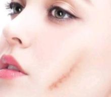 上?？瓢l(fā)源-你值得信賴的三甲整形醫(yī)院，快速了解附陽石保等醫(yī)生信息！