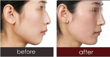 深圳哪些醫(yī)生已獲得2023年喬雅登認證？全新名單發(fā)布！