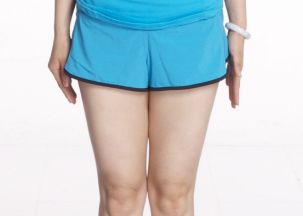 口碑醫(yī)師揭秘｜2023年易陽艷割雙眼皮價(jià)格曝光