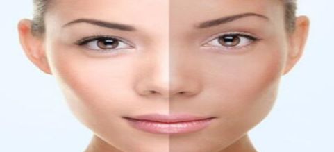 蘇薇潔成為上海九院眼部修復(fù)專家，病患們紛紛贊嘆！