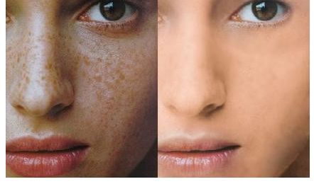 成都維度整形醫(yī)生技術(shù)點(diǎn)贊！實(shí)例曝光，周維做鼻子效果驚艷！