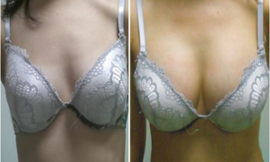 貴陽祛眼袋：TOP醫(yī)院推薦！麗都、美貝爾、美萊等整容專家鼎力推薦！