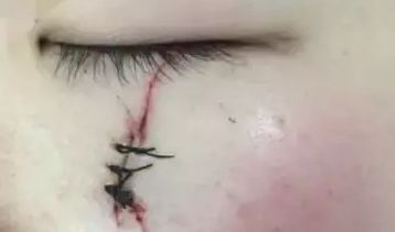 南京智美顏：了解2023吸脂案例曝光，發(fā)現醫(yī)療美容的驚人效果！