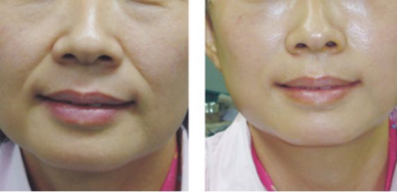 中國(guó)最值得信賴的整形醫(yī)院排行榜公開(kāi)！公立與私立醫(yī)院強(qiáng)強(qiáng)對(duì)決