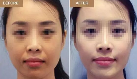 無錫市的優(yōu)秀整形美容機構排行榜，哪些醫(yī)院脫穎而出？