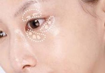 吳毅平醫(yī)生坐診醫(yī)院及隆胸案例分享，詳細(xì)介紹！