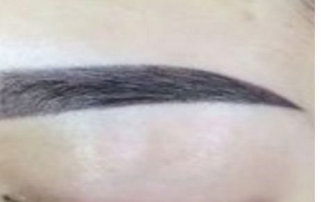 深圳哪家醫(yī)院的面部除皺效果出眾？透露美萊、鵬程、藝星等實(shí)力醫(yī)院排行榜