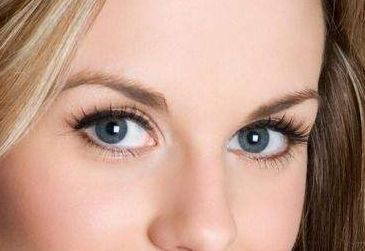 王玉潔醫(yī)生的雙眼皮技術(shù)及成功案例分享