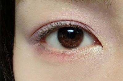 貴陽市激光脫毛服務品牌推薦