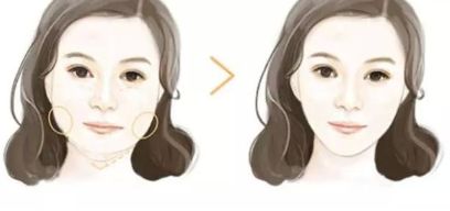 石家莊雙眼皮二次修復首選！排行榜公布最佳八強名單