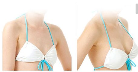 金長(zhǎng)鑫哪種技術(shù)祛眼袋效果更佳？眼袋手術(shù)最新案例解析！