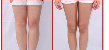 昆山人民醫(yī)院美容科提供哪些整形項(xiàng)目？著名醫(yī)師坐診+讓您雙眼煥發(fā)迷人魅力！