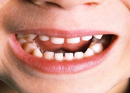 整形世界中，張笑天下頜角整形大概需要多少費用？醫(yī)院技術(shù)是如何保障的？