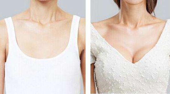 廣州割雙眼皮，哪家醫(yī)院技術(shù)高超？這幾家名聲不錯！