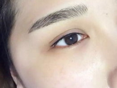 惠州去眼袋效果好的醫(yī)院有哪些？如何選擇效果好的醫(yī)院進行惠州去眼袋手術？