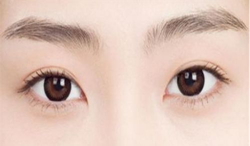 2023年廣州整形醫(yī)院首推雙眼皮修復(fù)，重磅名單揭曉！