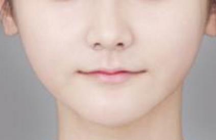 呼和浩特鼻部整形有哪些醫(yī)院可以信賴？為您推薦理想選擇