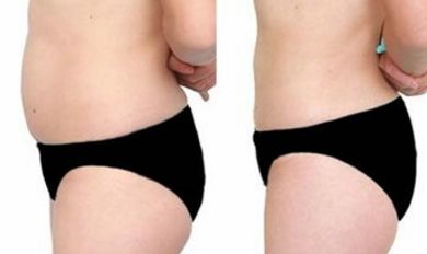 沈陽醫(yī)大一院醫(yī)美，尋覓技術(shù)高超的大夫，暢談假體隆鼻案例！