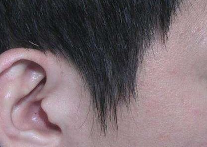 上海美容醫(yī)院盤點(diǎn)口碑排名，隆胸手術(shù)費(fèi)用公開曝光！