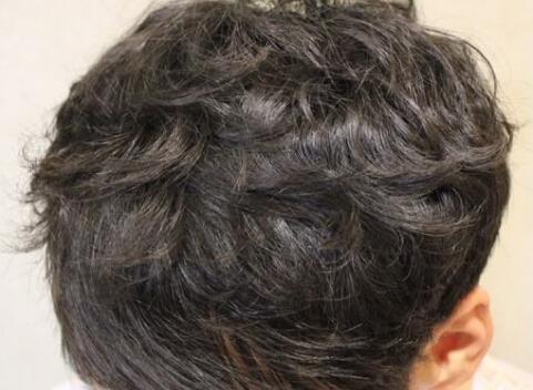 沈陽整形醫(yī)院哪家技術(shù)更先進(jìn)？有哪些正規(guī)醫(yī)美機構(gòu)？（附詳細(xì)價目表）