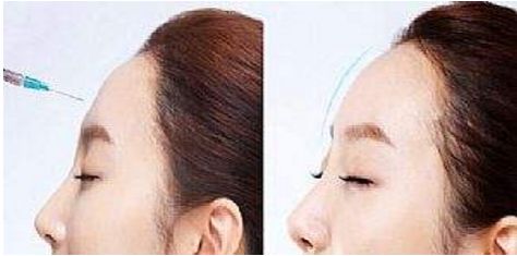 昆明市五星整形醫(yī)院排行榜top5，哪家效果好？醫(yī)美人士最愛！