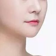 重磅推薦！全國(guó)頂級(jí)雙眼皮修復(fù)專家榜單揭曉，這四位醫(yī)師備受贊譽(yù)