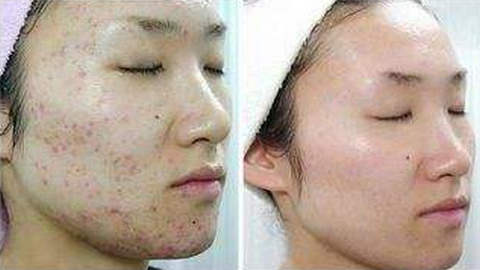 蘇州人民醫(yī)院整形科割眼袋靠譜嗎？專家資料簡(jiǎn)介，網(wǎng)友評(píng)價(jià)如何？