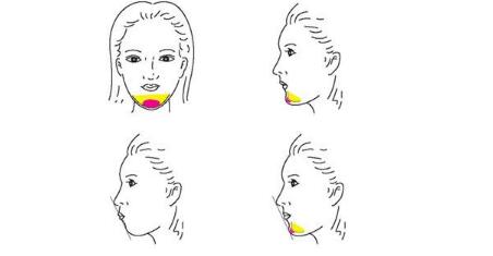 成都醫(yī)美醫(yī)院排名榜top5，是否包括權(quán)威專(zhuān)家的評(píng)選？