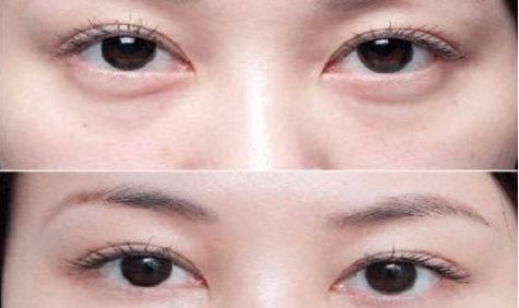 成都眼部整形醫(yī)生高分榜單發(fā)布！這些醫(yī)生哪家強(qiáng)？附詳細(xì)醫(yī)生信息