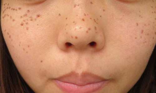 南京伊爾美醫(yī)療美容醫(yī)院真的可信嗎？有人分享他們的新醫(yī)院信息嗎？