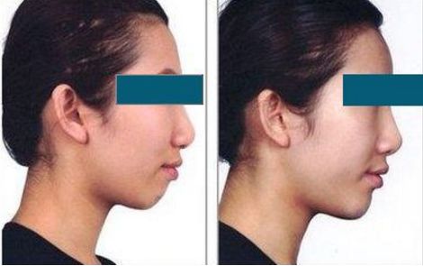 北京頂尖的整容專家排名揭曉！私人醫(yī)生榜單隆重公布