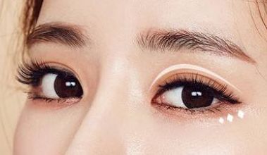 名師團(tuán)隊(duì)加持，葉飛輪打造雙眼皮，成就有形雙眼美！