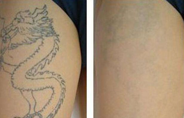 北京割雙眼皮哪家醫(yī)院口碑比較好？排名前三的醫(yī)院推薦！