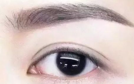 全國哪位專家值得信賴修復(fù)雙眼皮手術(shù)？頂級醫(yī)生排行榜首推名單揭曉