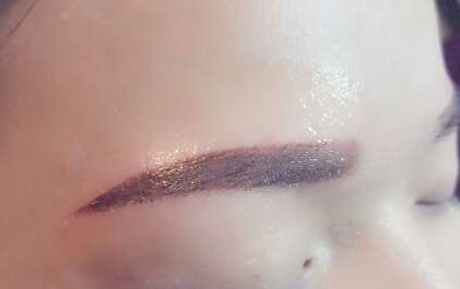 重慶眼角修復(fù)醫(yī)院有哪些？如何選擇合適的醫(yī)院進(jìn)行眼角修復(fù)？