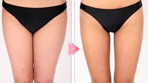 哈爾濱市十大雙眼皮整形醫(yī)生，絕對可信賴！