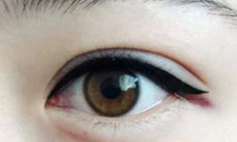 南京隆鼻術(shù)中高手脫穎而出！三位醫(yī)生實(shí)力強(qiáng)勁！