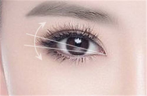 益陽康雅醫(yī)院美容整形科好不好？科室介紹是怎樣的？