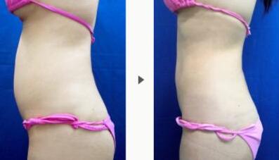 上海華美醫(yī)療美容整形醫(yī)院技術(shù)真的靠譜嗎？那里的醫(yī)生有經(jīng)驗(yàn)嗎？